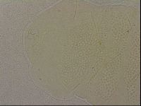 Echiniscus nigripustulus image