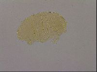Echiniscus nigripustulus image