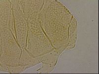 Echiniscus nigripustulus image