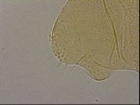Echiniscus nigripustulus image