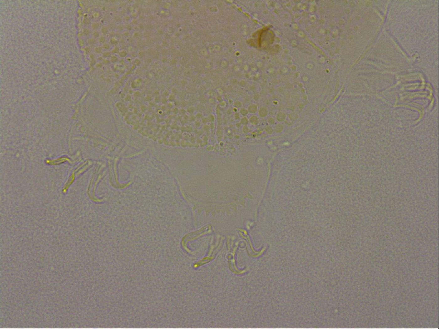 Echiniscus nigripustulus image