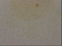 Echiniscus nigripustulus image