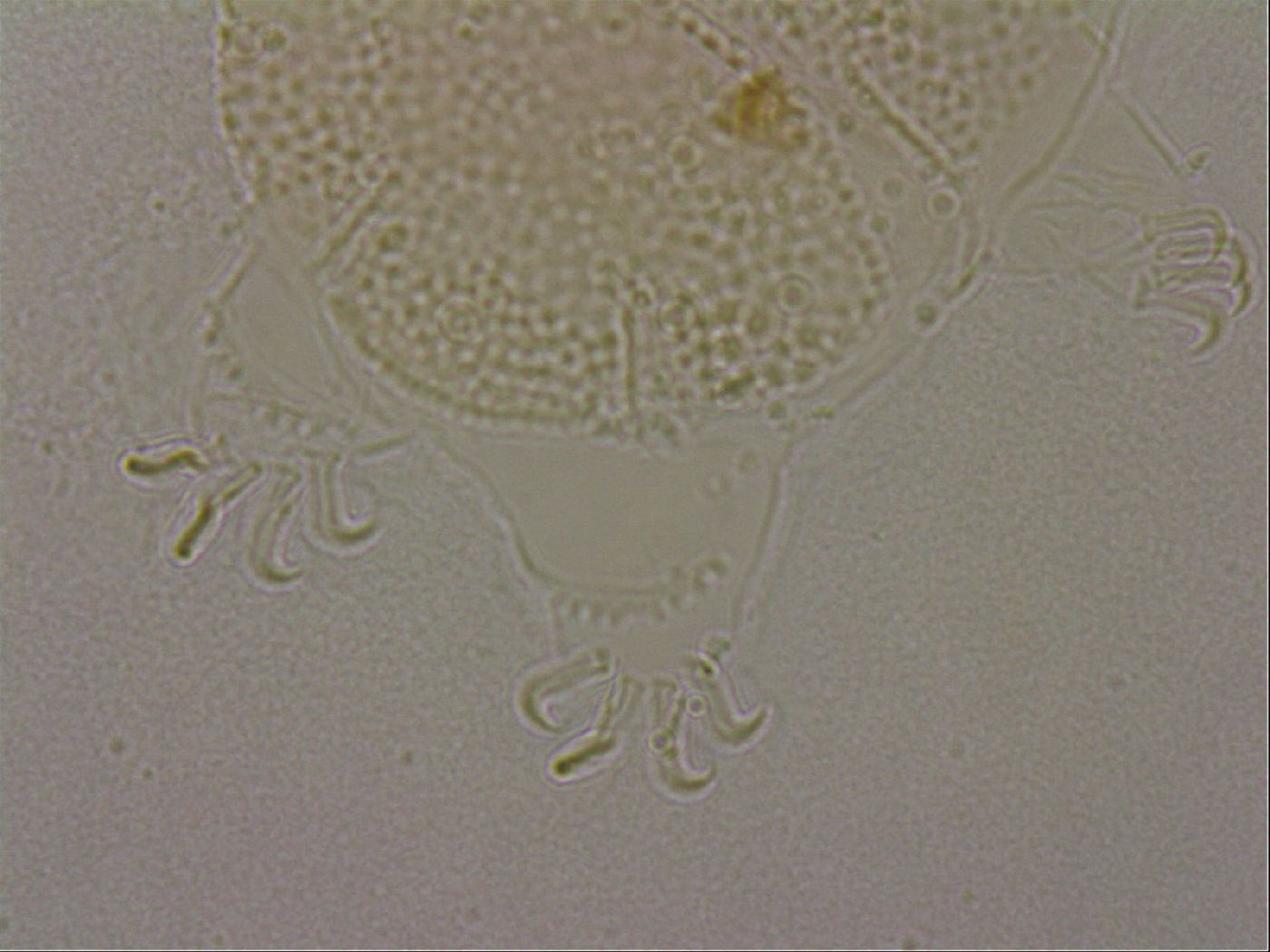 Echiniscus nigripustulus image