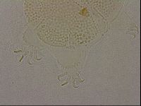 Echiniscus nigripustulus image