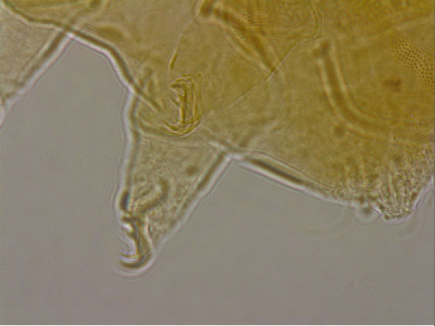Diploechiniscus oihonnae image