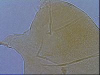 Diploechiniscus oihonnae image