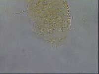 Media resource of Diploechiniscus oihonnae