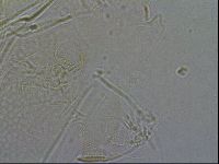 Diploechiniscus oihonnae image