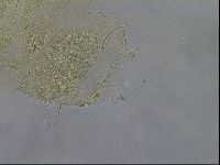 Diploechiniscus oihonnae image