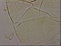 Diploechiniscus oihonnae image