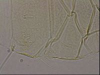 Diploechiniscus oihonnae image