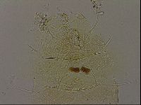 Diploechiniscus oihonnae image