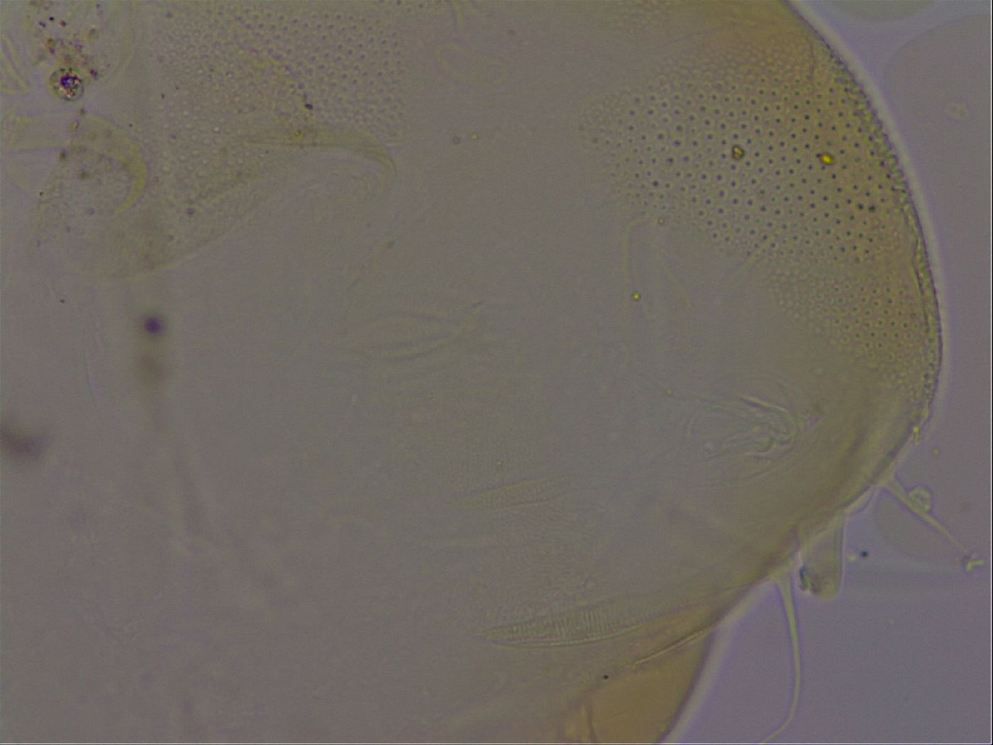 Echiniscus osellai image