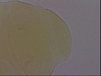 Echiniscus perarmatus image