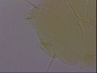 Echiniscus perarmatus image