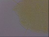Echiniscus perarmatus image