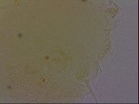 Echiniscus perarmatus image
