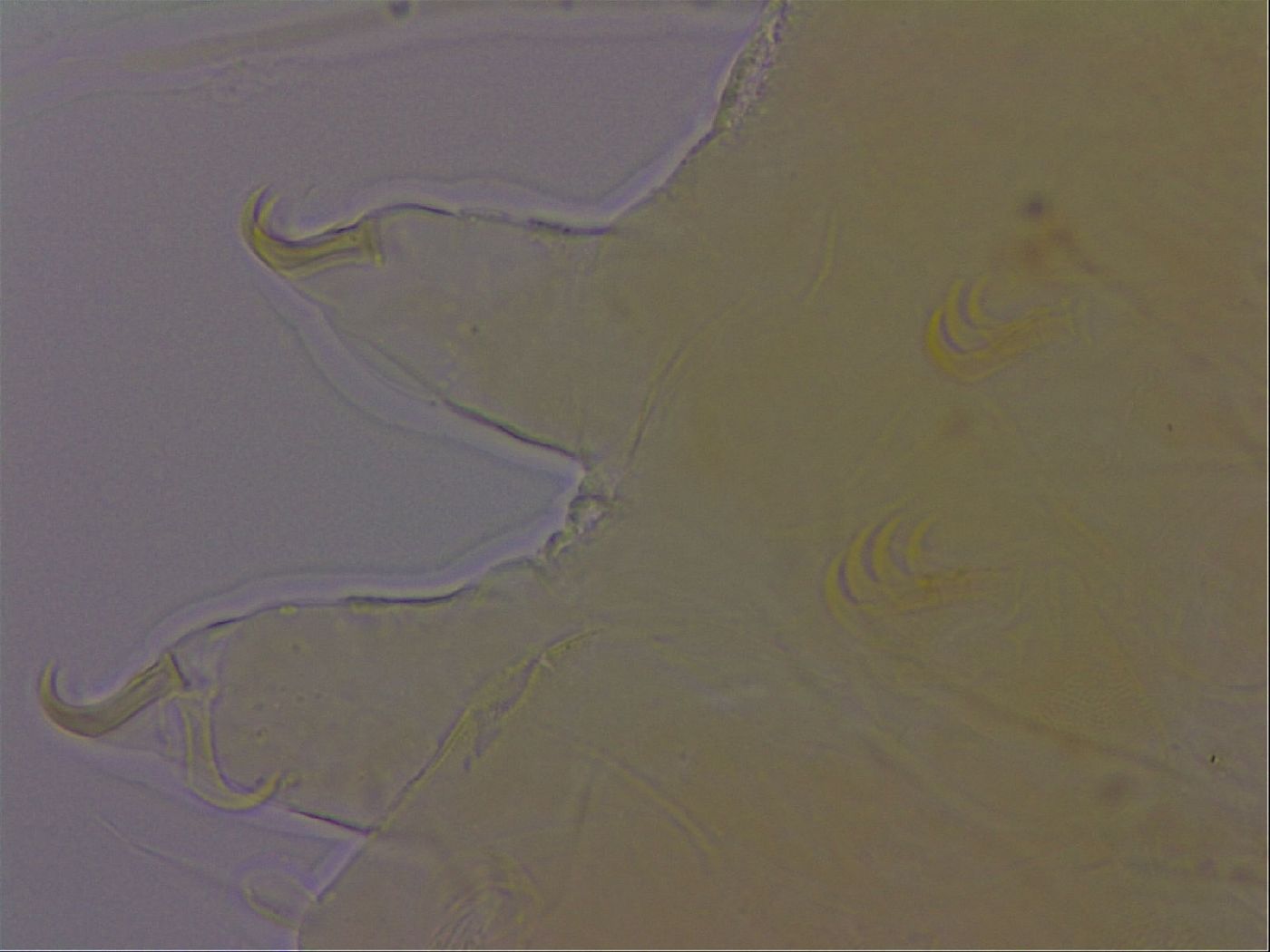 Echiniscus perarmatus image