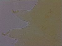 Echiniscus perarmatus image