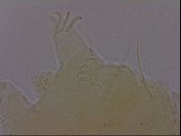 Echiniscus perarmatus image