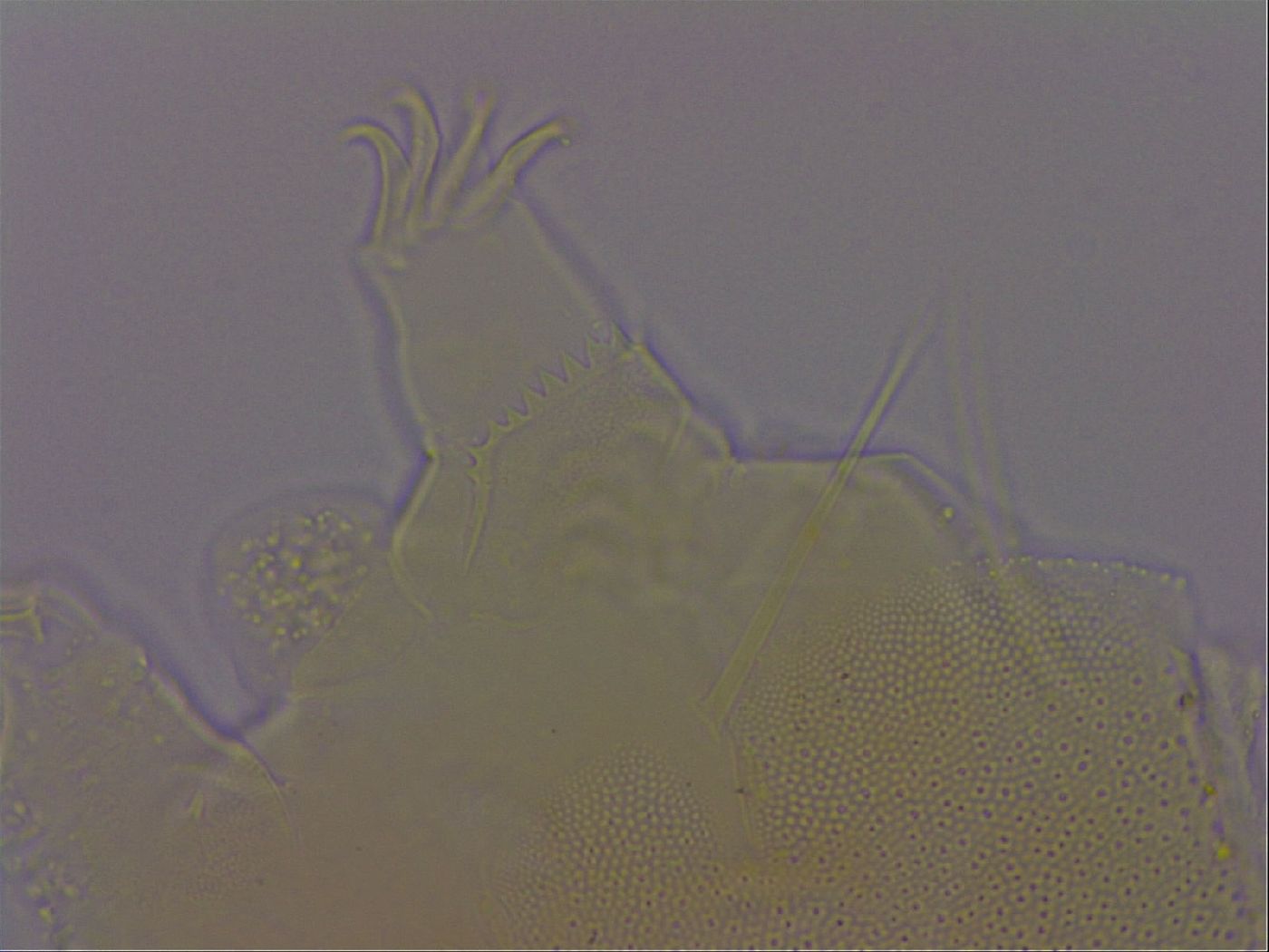 Echiniscus perarmatus image