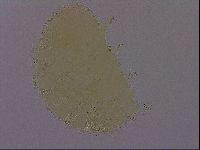 Echiniscus perarmatus image