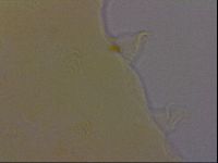 Echiniscus perarmatus image