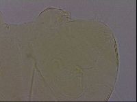 Echiniscus perarmatus image