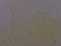 Echiniscus perarmatus image