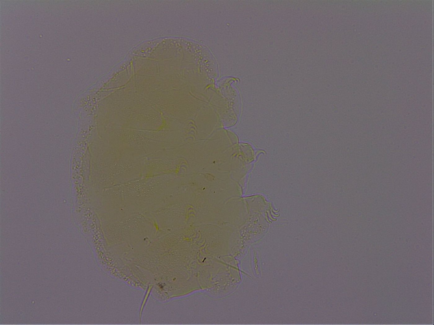 Echiniscus perarmatus image