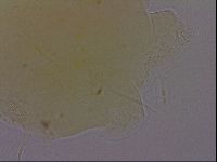 Echiniscus perarmatus image