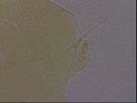 Echiniscus perarmatus image