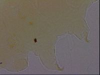 Echiniscus perarmatus image