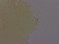 Echiniscus perarmatus image