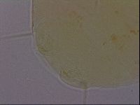 Echiniscus perarmatus image