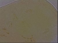 Echiniscus perarmatus image