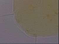 Echiniscus perarmatus image