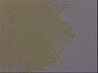 Echiniscus perarmatus image