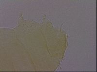 Echiniscus perarmatus image