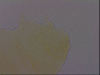 Echiniscus perarmatus image