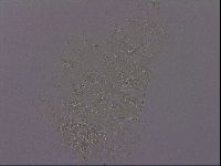 Echiniscus perarmatus image