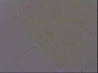 Echiniscus perarmatus image