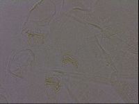 Echiniscus perarmatus image