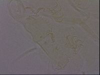 Echiniscus perarmatus image