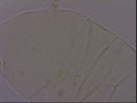 Echiniscus phocae image
