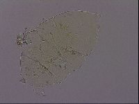 Echiniscus phocae image