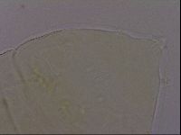 Echiniscus phocae image
