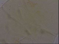 Echiniscus phocae image