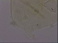 Echiniscus phocae image