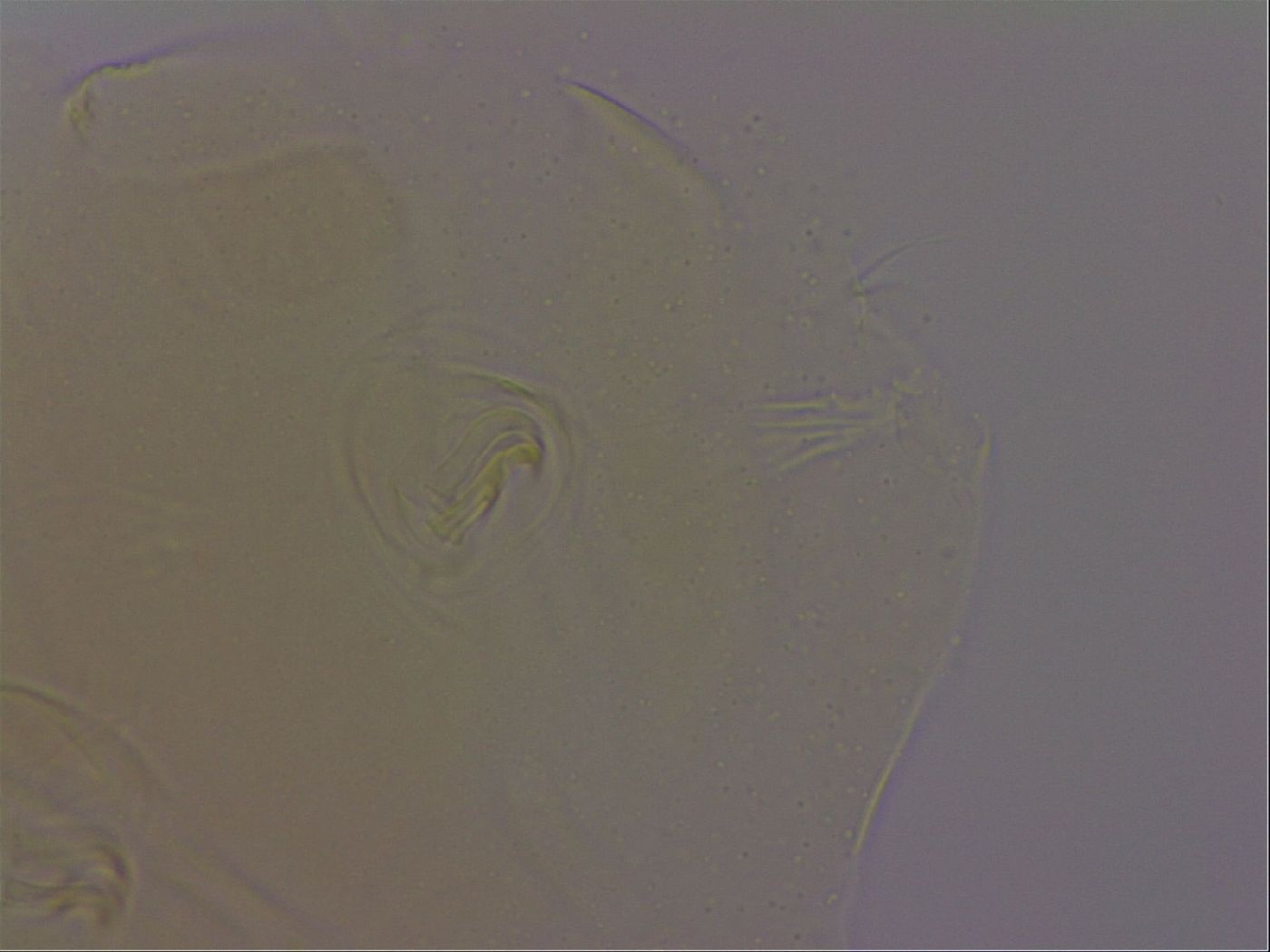 Echiniscus porabrus image